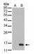 Dual Specificity Phosphatase 23 antibody, GTX108245, GeneTex, Western Blot image 
