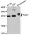 RAB21, Member RAS Oncogene Family antibody, A12095, ABclonal Technology, Western Blot image 