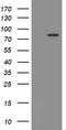 Peptidyl Arginine Deiminase 4 antibody, TA504897BM, Origene, Western Blot image 