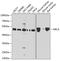 MHC Class I Polypeptide-Related Sequence A antibody, GTX64407, GeneTex, Western Blot image 