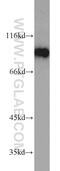 DExD-Box Helicase 21 antibody, 10528-1-AP, Proteintech Group, Western Blot image 
