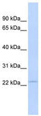 Proteasome Subunit Beta 3 antibody, TA342166, Origene, Western Blot image 