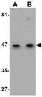 EGF Containing Fibulin Extracellular Matrix Protein 1 antibody, GTX31792, GeneTex, Western Blot image 