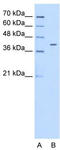 Pregnancy Specific Beta-1-Glycoprotein 6 antibody, TA346260, Origene, Western Blot image 