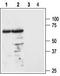 Melanocortin 3 Receptor antibody, TA328872, Origene, Western Blot image 