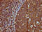 Immunoglobulin Heavy Constant Mu antibody, CSB-PA360788LA01HU, Cusabio, Immunohistochemistry frozen image 