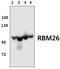 RNA Binding Motif Protein 26 antibody, PA5-75975, Invitrogen Antibodies, Western Blot image 