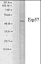 Protein Disulfide Isomerase Family A Member 3 antibody, orb95881, Biorbyt, Western Blot image 