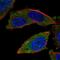 E3 ubiquitin-protein ligase RNF123 antibody, NBP2-57940, Novus Biologicals, Immunocytochemistry image 