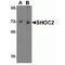 SHOC2 Leucine Rich Repeat Scaffold Protein antibody, TA306795, Origene, Western Blot image 