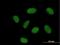 RRAD And GEM Like GTPase 2 antibody, H00161253-B01P, Novus Biologicals, Immunofluorescence image 
