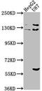 Suppression of tumorigenicity 5 protein antibody, CSB-PA022758LA01HU, Cusabio, Western Blot image 