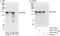 Desmoglein 2 antibody, A303-756A, Bethyl Labs, Immunoprecipitation image 