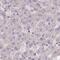 Prefoldin subunit 6 antibody, PA5-60207, Invitrogen Antibodies, Immunohistochemistry paraffin image 