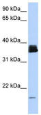 Peptidyl-prolyl cis-trans isomerase A antibody, TA339205, Origene, Western Blot image 