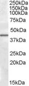 Calcium/Calmodulin Dependent Protein Kinase ID antibody, TA305711, Origene, Western Blot image 