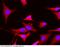 NME1 antibody, 11615-MM01, Sino Biological, Immunohistochemistry paraffin image 