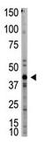 Myostatin antibody, ab71808, Abcam, Western Blot image 
