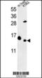 Ribosomal Protein L37 antibody, 64-006, ProSci, Western Blot image 