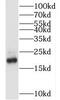 RLC antibody, FNab05484, FineTest, Western Blot image 