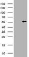 Vimentin antibody, CF801122, Origene, Western Blot image 