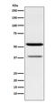 Carcinoembryonic Antigen Related Cell Adhesion Molecule 6 antibody, M03197-1, Boster Biological Technology, Western Blot image 