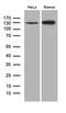 Lysine Demethylase 3A antibody, LS-C796272, Lifespan Biosciences, Western Blot image 