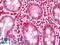 Histone lysine demethylase PHF8 antibody, LS-B11788, Lifespan Biosciences, Immunohistochemistry frozen image 