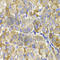 Melanoma-associated antigen D1 antibody, A1092, ABclonal Technology, Immunohistochemistry paraffin image 