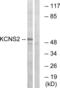 Potassium Voltage-Gated Channel Modifier Subfamily S Member 2 antibody, abx014735, Abbexa, Western Blot image 