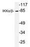 Inhibitor of nuclear factor kappa-B kinase subunit alpha antibody, AP20346PU-N, Origene, Western Blot image 