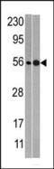NMD3 Ribosome Export Adaptor antibody, 60-570, ProSci, Western Blot image 