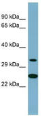 Protein Kinase AMP-Activated Non-Catalytic Subunit Beta 2 antibody, TA342245, Origene, Western Blot image 