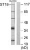Suppression of tumorigenicity 18 protein antibody, GTX87918, GeneTex, Western Blot image 