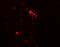 Rubicon Autophagy Regulator antibody, 7943, ProSci Inc, Immunofluorescence image 