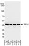 Ribosomal Protein L6 antibody, NBP2-04034, Novus Biologicals, Western Blot image 