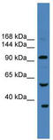 Ubiquitin Specific Peptidase 29 antibody, TA342573, Origene, Western Blot image 