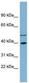 Isocitrate Dehydrogenase (NAD(+)) 3 Alpha antibody, TA346408, Origene, Western Blot image 