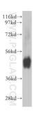 Neuromedin U Receptor 1 antibody, 14619-1-AP, Proteintech Group, Western Blot image 