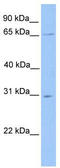 Nuclear Receptor Subfamily 1 Group D Member 2 antibody, TA343507, Origene, Western Blot image 