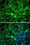 Ribosomal Protein Lateral Stalk Subunit P1 antibody, 22-439, ProSci, Immunofluorescence image 