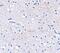 F-Box And Leucine Rich Repeat Protein 20 antibody, NBP1-76868, Novus Biologicals, Immunohistochemistry frozen image 