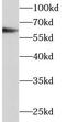 Prolyl 4-hydroxylase subunit alpha-1 antibody, FNab06078, FineTest, Western Blot image 