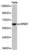 Lamin B1 antibody, TA327367, Origene, Western Blot image 