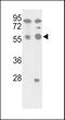 Protein Phosphatase 5 Catalytic Subunit antibody, LS-C101088, Lifespan Biosciences, Western Blot image 