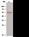 Carnosine Dipeptidase 2 antibody, 50246-RP02, Sino Biological, Immunoprecipitation image 