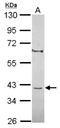 Chromosome 8 Open Reading Frame 48 antibody, NBP2-15652, Novus Biologicals, Western Blot image 