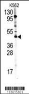 Protein Arginine Methyltransferase 8 antibody, TA302105, Origene, Western Blot image 