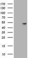 Thymidine Phosphorylase antibody, TA800978S, Origene, Western Blot image 