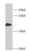 HMGN1 antibody, FNab03931, FineTest, Western Blot image 